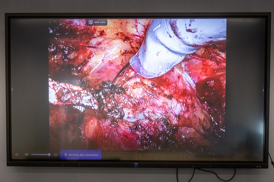 Konferencja prasowa w WSZ, fot. Szymon Zdziebło/tarantoga.pl dla UMWKP