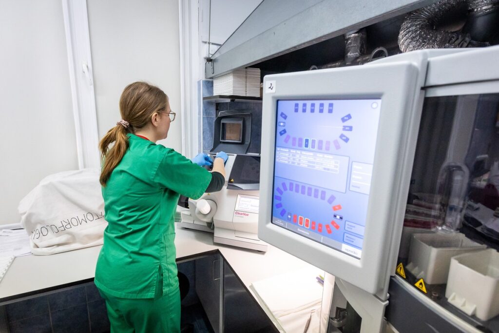 Nowa aparatura w zakładzie patomorfologii Centrum Pulmonologii, fot. Tomasz Czachorowski/eventphoto dla UMWKP